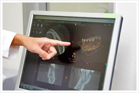 歯科用CTによる正確・安全な診療
